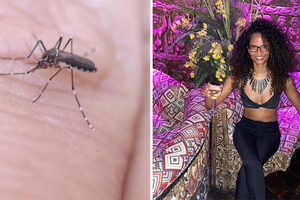 35歲女舞者「被蚊子叮」陷昏迷　醒來驚見「手腳全沒了」