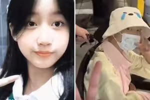 才喊我要活下去！「化療16次」撐不住了　13歲小網紅證實離世