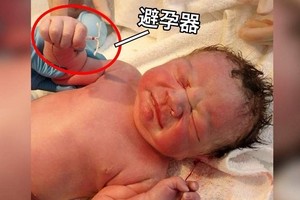 地表最強嬰兒！小男嬰「手抓著媽媽避孕器」強勢出生，照片秒飆破7萬人按讚：1%的奇蹟！