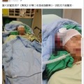 17歲少年遭警開槍擊中頭　母親臉書集氣