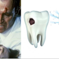 阿茲海默症的要意外讓「蛀牙自行修復」，以後不再需要補牙但還是要被鑽牙！