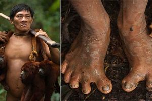 這個神秘的部落「所有人都靠吃猴子生存」，他們的身體構造已經從腳部開始變形…