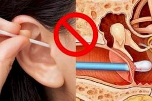 「常用棉花棒來清理耳朵」這會給你耳朵帶來很大的傷害