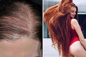 這個正妹曾經「脫髮禿頭」完全不敢直視鏡子，但是現在卻有超過100公分的紅髮美到像是天使下凡！