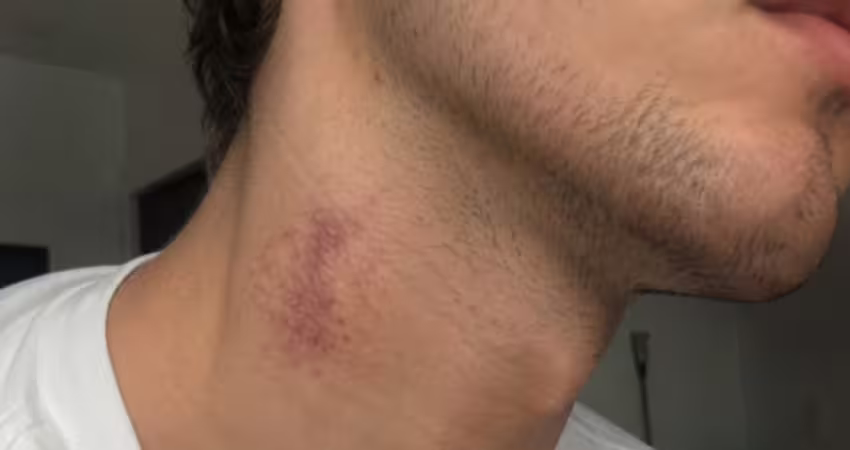 男子早餐店「口吐白沫」身亡　醫揭「種草莓」釀禍！女友哭崩