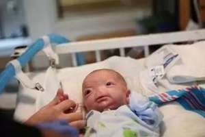 這個嬰兒出生就沒有鼻子，可當他笑起來時讓所有人為他感動！