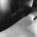 踢到桌腳以為僅瘀青 女子最後切大拇指保命