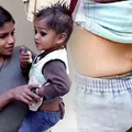 3歲印度小男童背後長了尾巴，每次要動手術移除時怪事連連！爸爸超自豪：「我兒子是猴神轉世！」