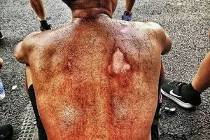 出勤空檔練兵！消防員背部曬到「燒焦」　網友看了都想哭…