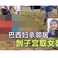 变态妇杀邻居 剖子宫取女婴