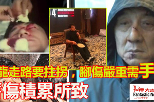 64歲成龍走路要拄拐，腳傷嚴重需手術，卻一直拖延治療時間，原因..