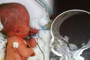 肚子裡的寶寶「沒有大腦」，醫生建議拿掉但她堅持產下，沒想到4年後的「大腦掃描照」震驚全球！