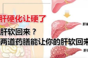 你 的 肝 已 經 【硬化】了？！ 只需要用這個方法就能讓肝「軟」回來哦！