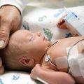 避免嬰兒早期死亡 了解先天出生缺陷