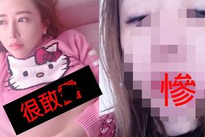 婚禮突取消…小開男友破產女星深情幫籌錢！卻慘吃男方「昇龍拳」…打殘變豬頭