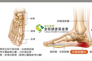 一個動作告訴你 你是否有足底筋膜炎！