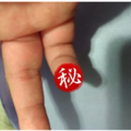 嚇傻！睡到一半突小指痛 她睜眼驚見蟑螂狂咬手