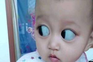 剛出生寶寶眼睛大的像「銅鈴」，夫妻二人擔心孩子出問題去醫院檢查，結果讓人哭笑不得！