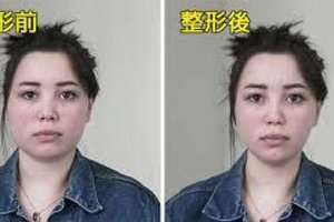 【國際】這個6個外國人請韓國整容師幫他們【模擬應該怎麼正】第6個女生就會讓你明白差一點其實差很多