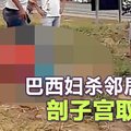 巴西妇杀邻居 剖子宫取女婴