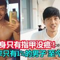 被死神選上的癌症末期病患 壯男：我全身只有指甲沒癌 