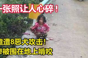 童遭8惡犬攻擊！慘被圍在地上啃咬 , 一張照讓人心碎 