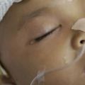 六歲懂事娃墜樓昏迷，單身父親百天呼喚含淚捐器官，挽救三人生命