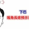 下巴、嘴角長痣預示著什麼?