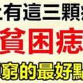 身上有這3顆痣是「貧困痣」不想窮,最好點掉