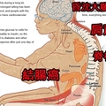 嚇！「久坐」竟比吸菸更致命！！拚命運動也救不了你！只要這樣做，立即預防「久坐癌」！一定要分享出去！