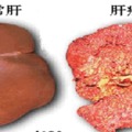 一分鐘體檢！原來肝生病會有「這些症狀」，趕快看看你有沒有！