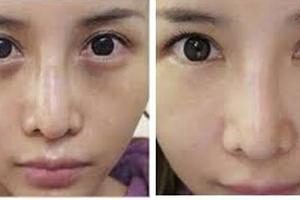 放屁、口臭、眼袋浮腫 ...醫學專家們總結的15個常見健康問題化解竅門！