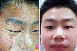 復活了！臉上斑一吃就立馬變白，三天內暗黃、雀斑、黑點全消失了！神到不敢相信！!