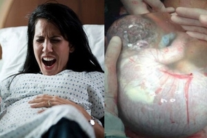嬰兒「早產」情況超危急！但就在醫生看到「這一幕後」，竟然就笑了．．．這個原因讓人超驚喜！
