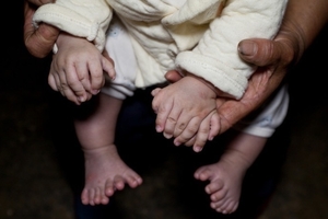  太驚人了！3個月大男嬰天生手指有15根、腳指有16根、四個手掌！竟然因為他的媽媽是...