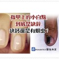 指甲上的小白點，到底是缺鋅、缺鈣還是有蛔蟲？