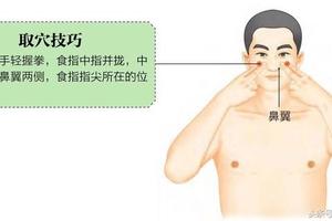 穴位養生｜流鼻涕、鼻塞、過敏性鼻炎按迎香穴，祛風通竅理氣止痛
