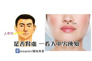 是否腎虛 一看“人中穴”便知