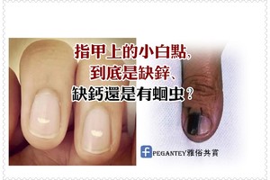 指甲上的小白點，到底是缺鋅、缺鈣還是有蛔蟲？
