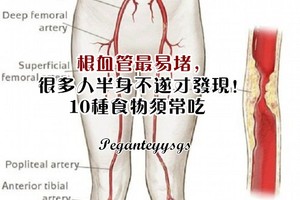 根血管最易堵，很多人半身不遂才發現！10種食物須常吃