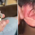 戴中國熱銷藍牙耳機　突在男大生耳內爆炸！專家揭真相了