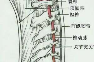 頸椎拍片，X光報告提示「項韌帶鈣化」是什麼意思？