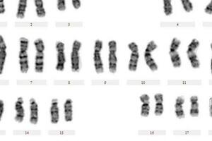 「染色體」報告你看懂了嗎？