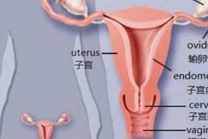 子宮內膜癌：了解症狀和治療 子宮內膜癌是一種常見的...