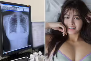 寫真偶像炫耀「我的肺很乾淨!」 網看X光全歪樓:太刺激了 寫真偶像炫耀「我的肺很乾淨!」 網看X光全歪樓:太刺激了