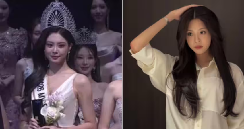 父親是男神！23歲最美星二代奪選美冠軍　遭挖「童年舊照」網愣：該頒獎給整形醫生