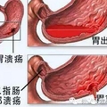 胃不好的如何養胃，正所謂“三分治七分養”，養胃秘訣都幫你收集好了～不看是自己的損失！