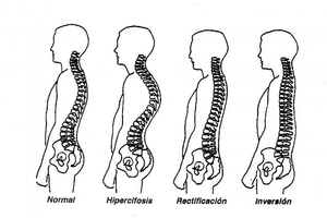 脊椎是人的命根，長歪了生百病，更會出人命！這些方法我試了一週脊椎都挺了，身體舒適多！很簡單不妨試試看！