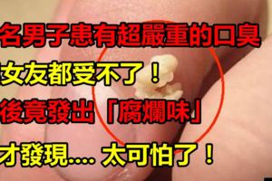 一名男子患有超嚴重的口臭，連女友都受不了！最後竟發出「腐爛味」後才發現....太可怕了！