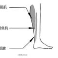 拯救粗壯小腿，三個方法：小腿更瘦、更細長！